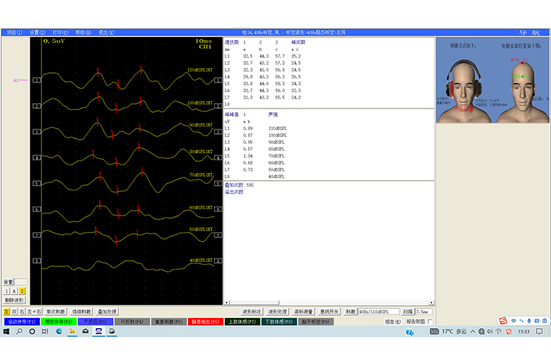 092波形图-听觉诱发-40Hz稳态听觉