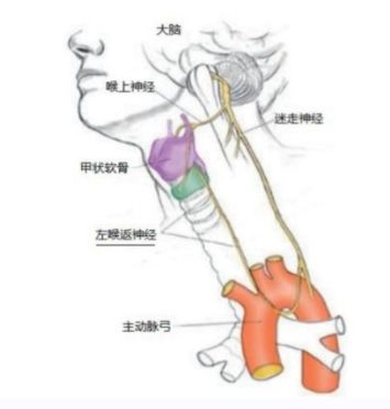 海神“喉返贴片电极”横空出世！解决喉返神经损伤问题